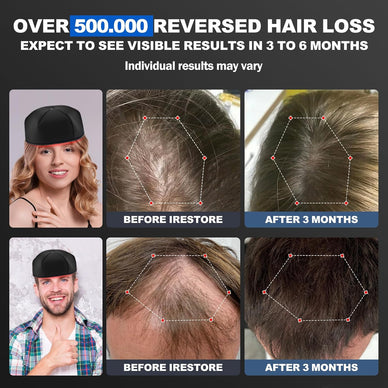 "Rediscover Confidence with Thicker, Fuller Hair"